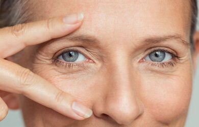 – Docteur Bernard Hayot New eyelid surgery: augmentation blepharoplasty