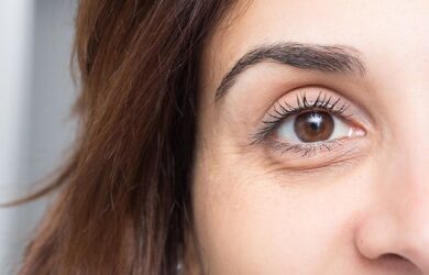 Treatment of dark circles: From aesthetic medicine to cosmetic surgery