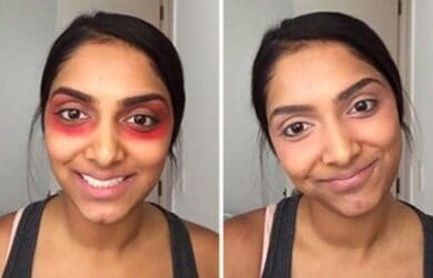 – Docteur Bernard Hayot Treating dark circles with a tube of lipstick