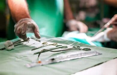 Lipofillings