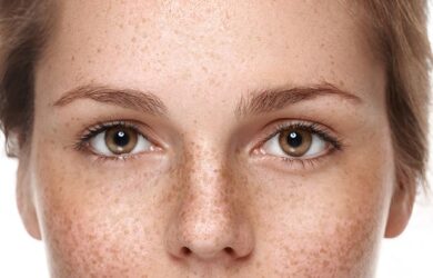– Docteur Bernard Hayot Medical rhinoplasty: correction of the shape of the nose without surgery