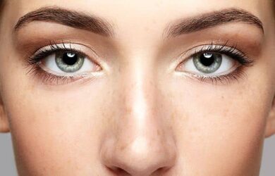 Effective treatments for under-eye puffiness