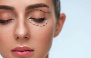 Rejuvenate your look with addition blepharoplasty