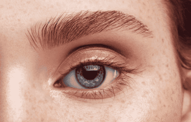 How do I remove dark circles?