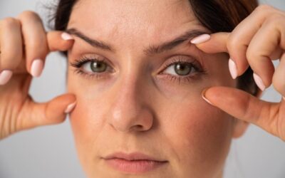 – Docteur Bernard Hayot Does blepharoplasty leave scars on the eyelids?