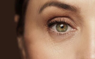 – Docteur Bernard Hayot What are the effects of bags under the eyes?