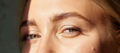 – Docteur Bernard Hayot Lipofilling des poches sous les yeux pour un regard naturel