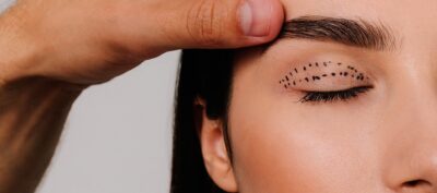 Blépharoplastie Deep-Plane + Nanolipofilling : La Révolution Sans Cicatrices du Regard 2026