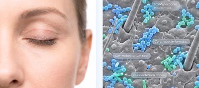– Docteur Bernard Hayot Microbiome Cutané Péri-Oculaire en Blépharoplastie : Accompagnement Post-Opératoire Innovant