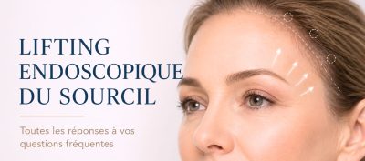 Endoscopic brow lift: 8 questions my patients ask me
