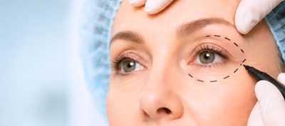 – Docteur Bernard Hayot Ambulatory Blepharoplasty in Paris: The Complete Guide for a Rejuvenated Look